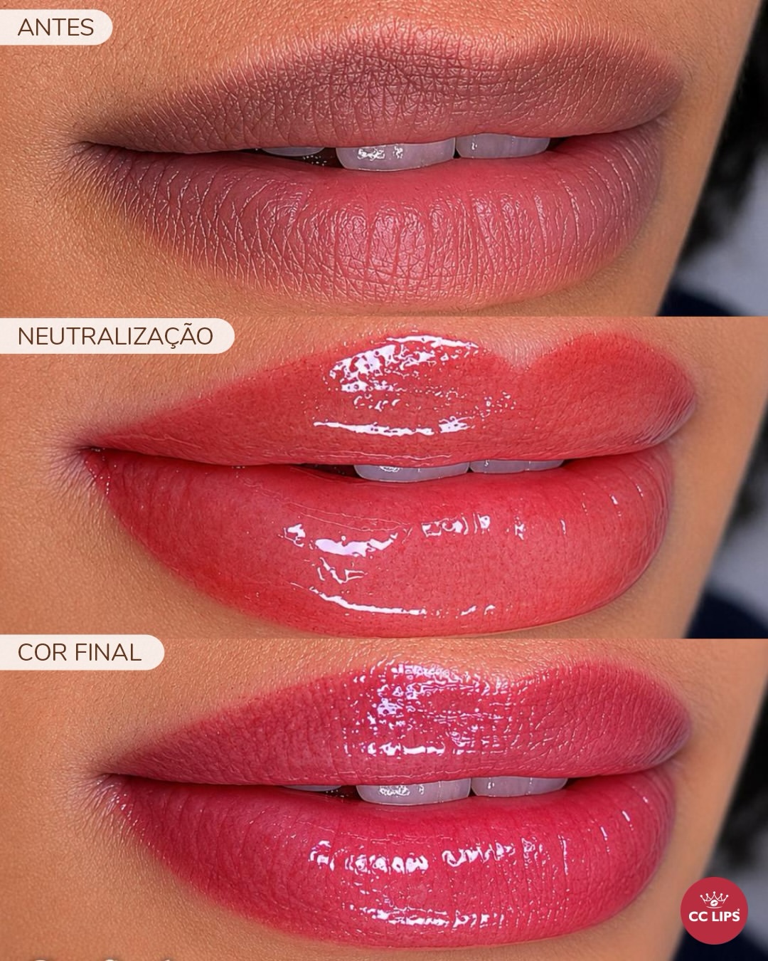 neutraliza2