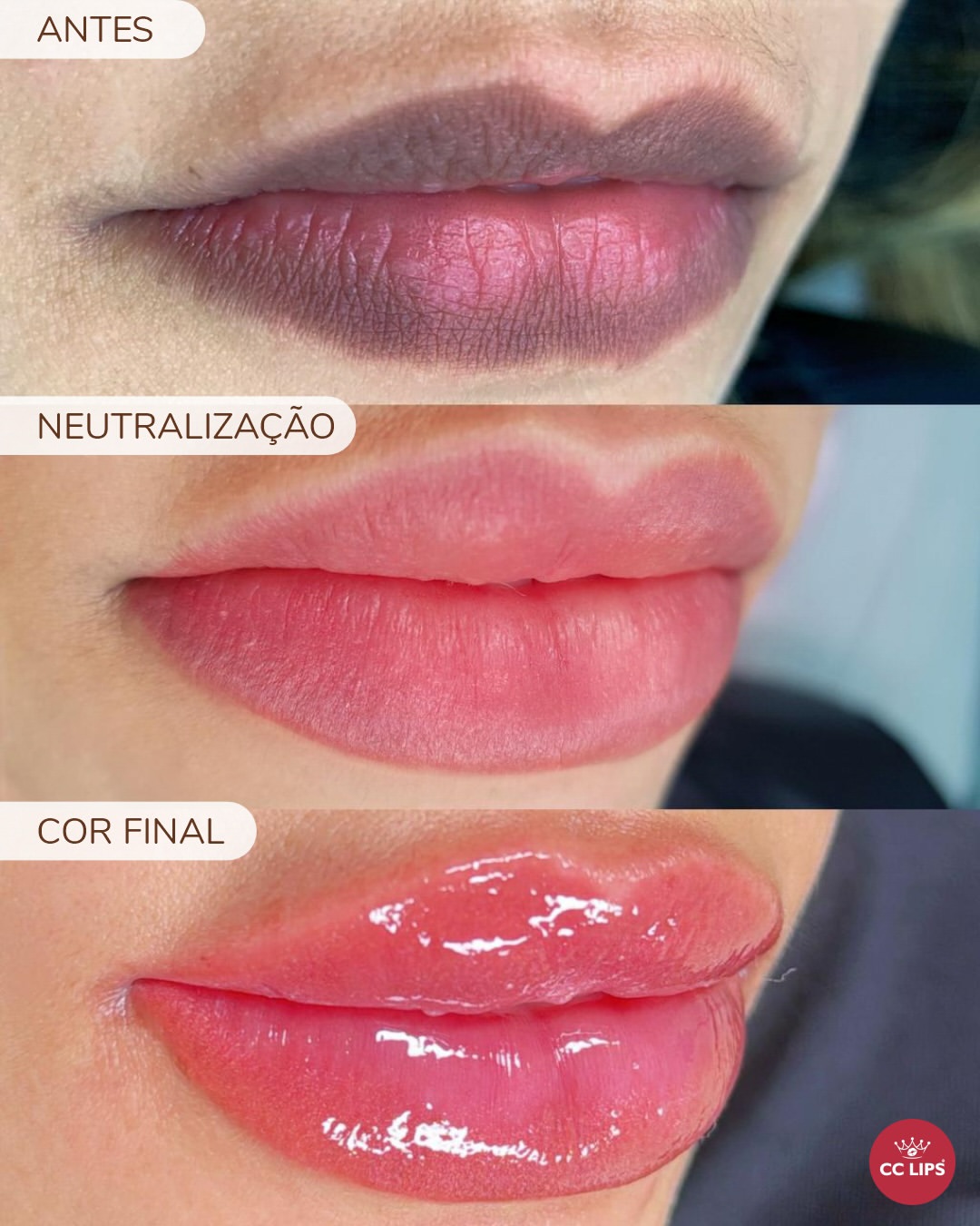 neutraliza8